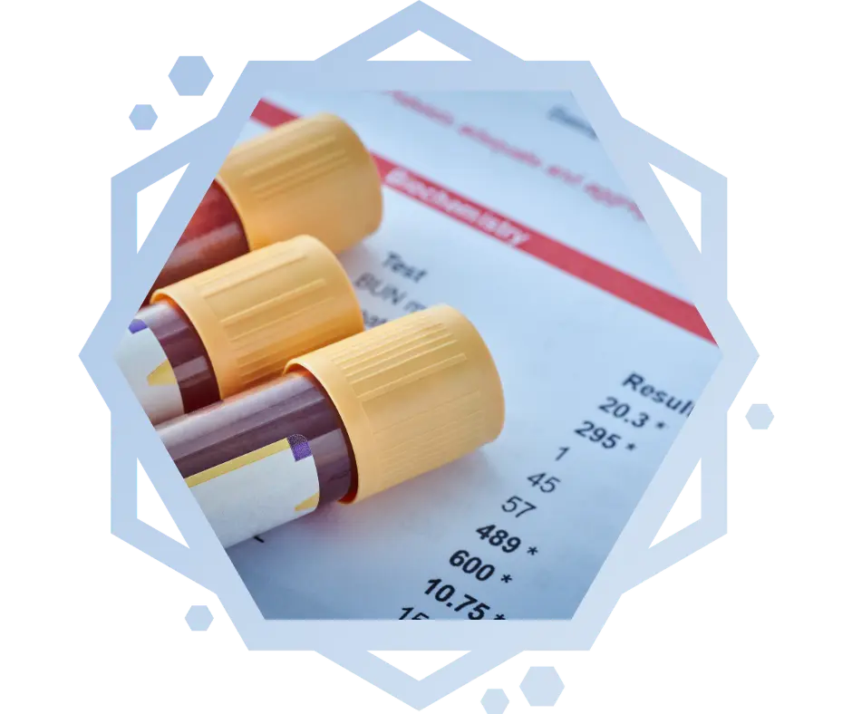 timeline on how long fentanyl stays in your bloodwork